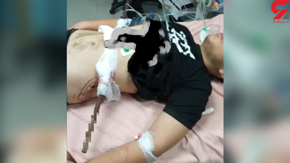 فرو رفتن وحشتناک میلگرد در بدن کارگر جوان در آستانه اشرفیه